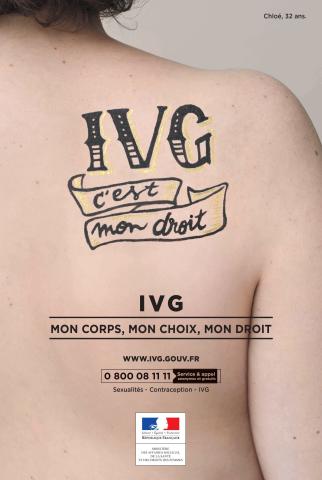 IVG